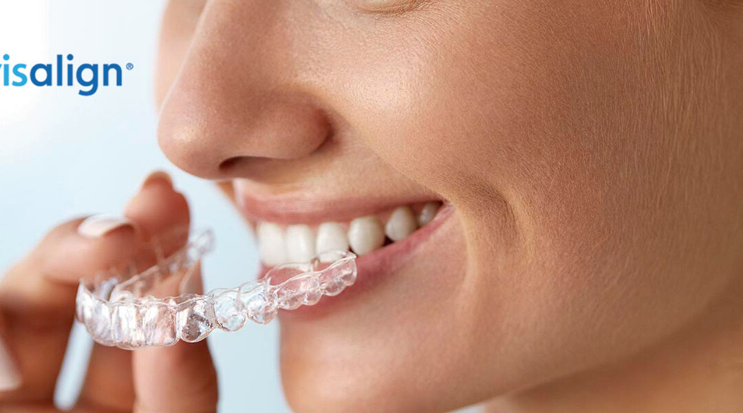 Invisalign Ortodoncia Invisible Barcelona Clinica Aguilar Dental Salut